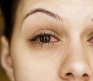 Chế độ ăn và cách sinh hoạt phòng chống khô mắt