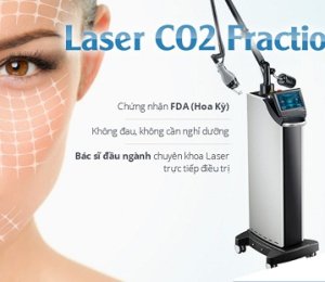 Laser CO2